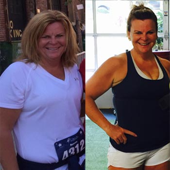 Before and After - Kathleen Murphy